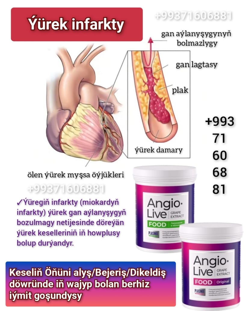 Ýürek infarkty. Miokardyň infarkty. Yürek işemiya. Yürek kesellerinin öňüni almak, bejermek, dikeltmek üçin berhiz iýmit goşundysy. Вертера Алфа. Vertera Türkmenistan. Angiolive ek üçin iý