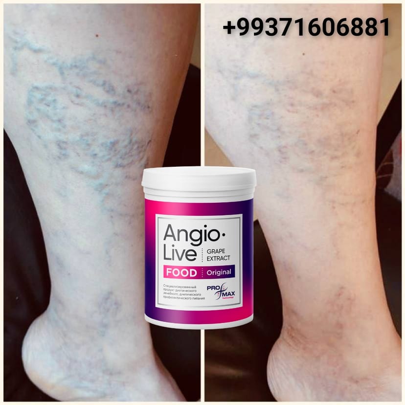 Warikozyň öňüni almak we ýeňilleşdirmek üçin 