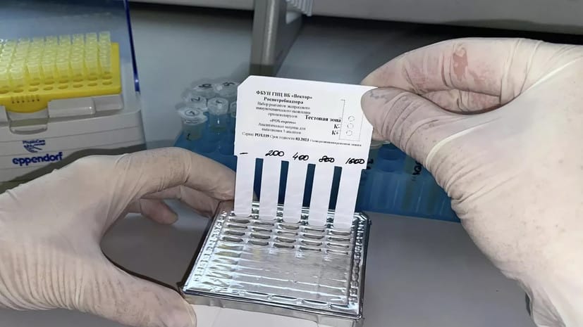 Russiýa Türkmenistana maýmyn mamasyny anyklaýyş testlerini iberdi